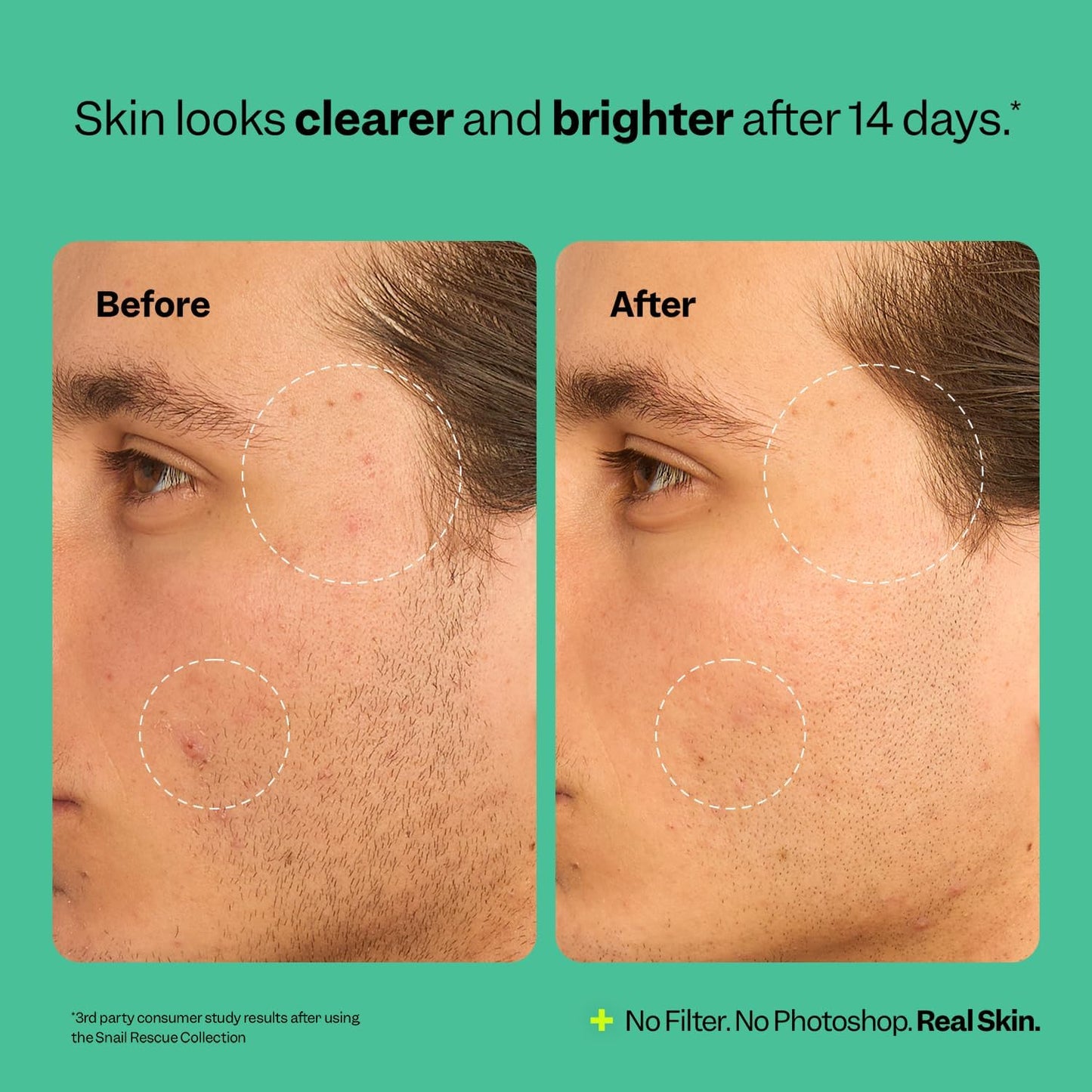 Snail Rescue Blemish Busting Toner (4.05 oz)