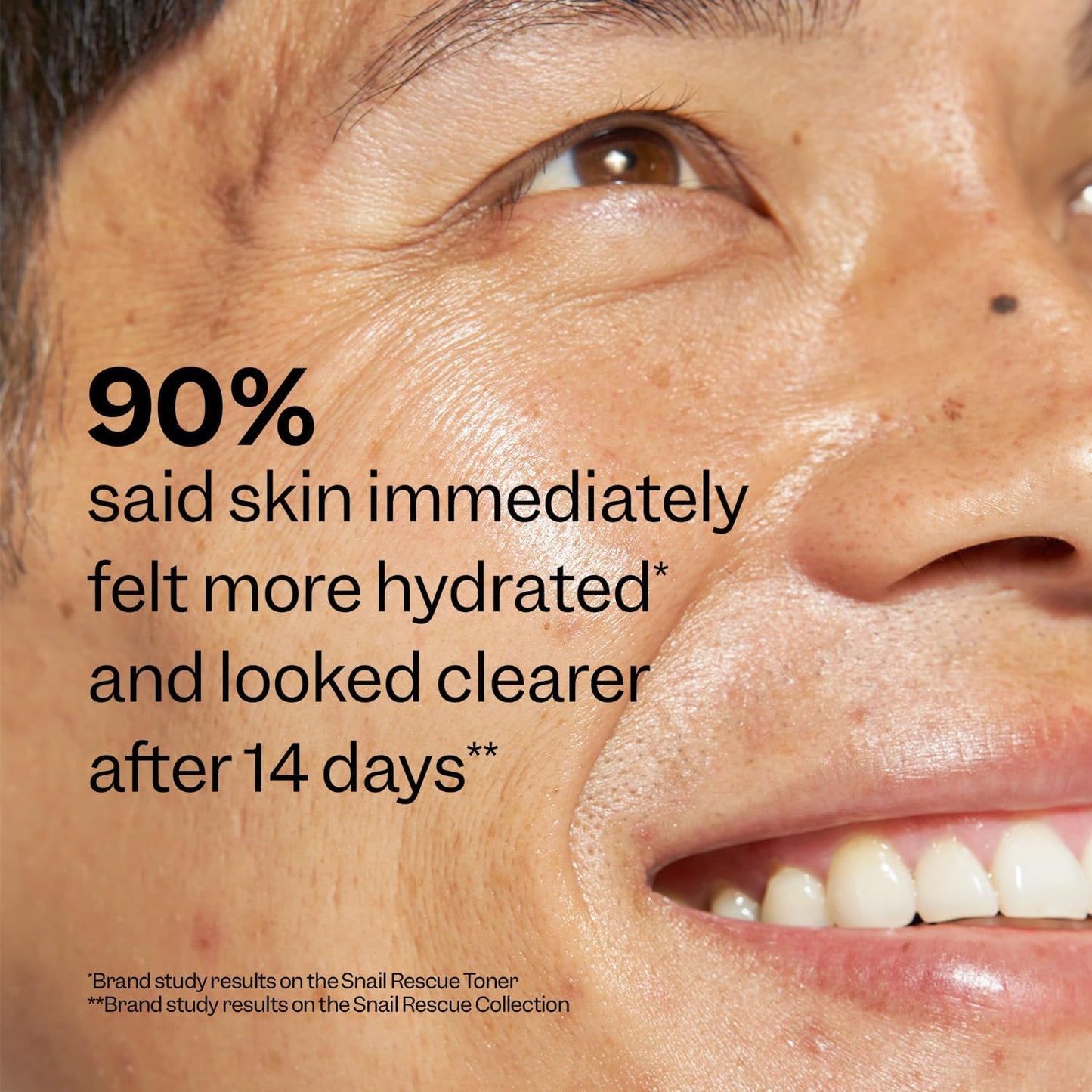 Snail Rescue Blemish Busting Toner (4.05 oz)