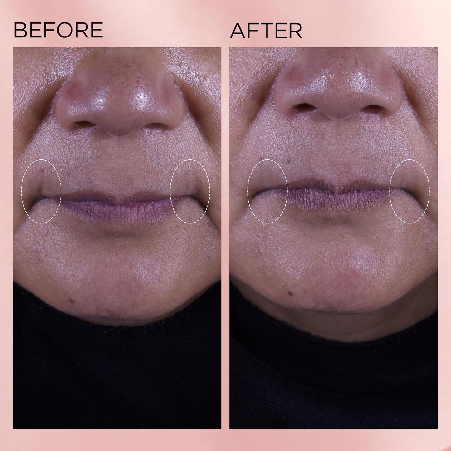 Retinol + HPR Ceramide Rapid Skin Renewing Water Cream (1.7 fl oz)