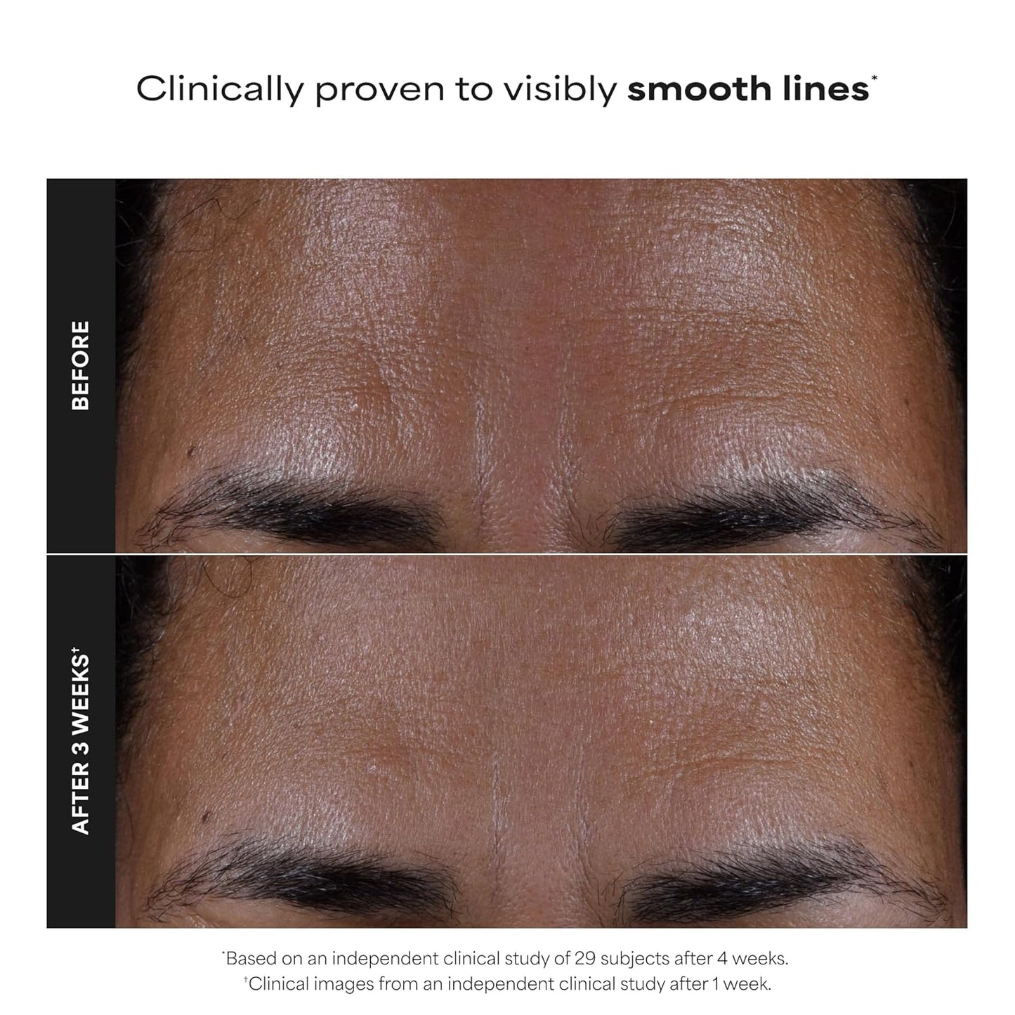 Skin Perfecting 2% BHA Liquid Exfoliant (4 fl oz)