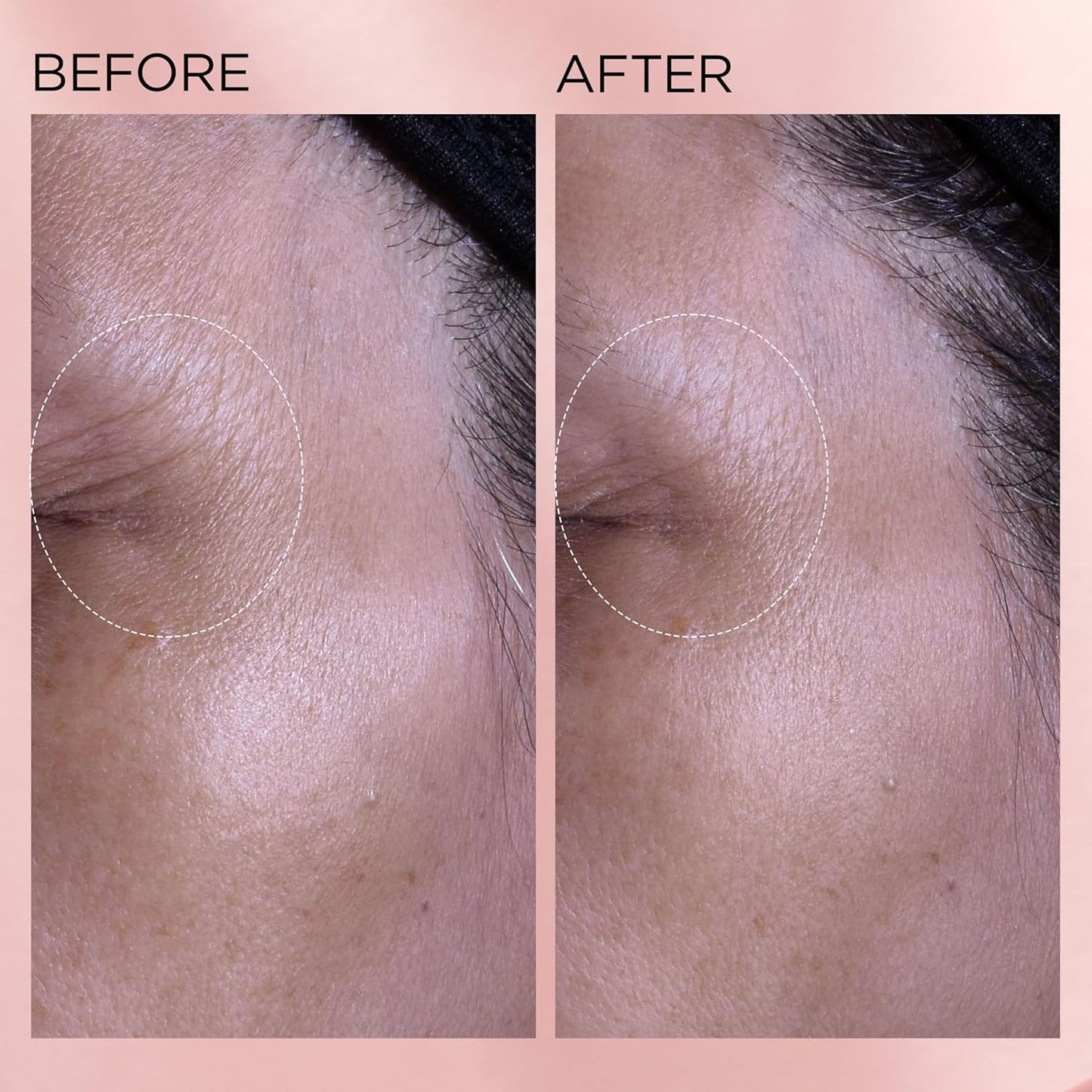 Retinol + HPR Ceramide Rapid Skin Renewing Water Cream (1.7 fl oz)
