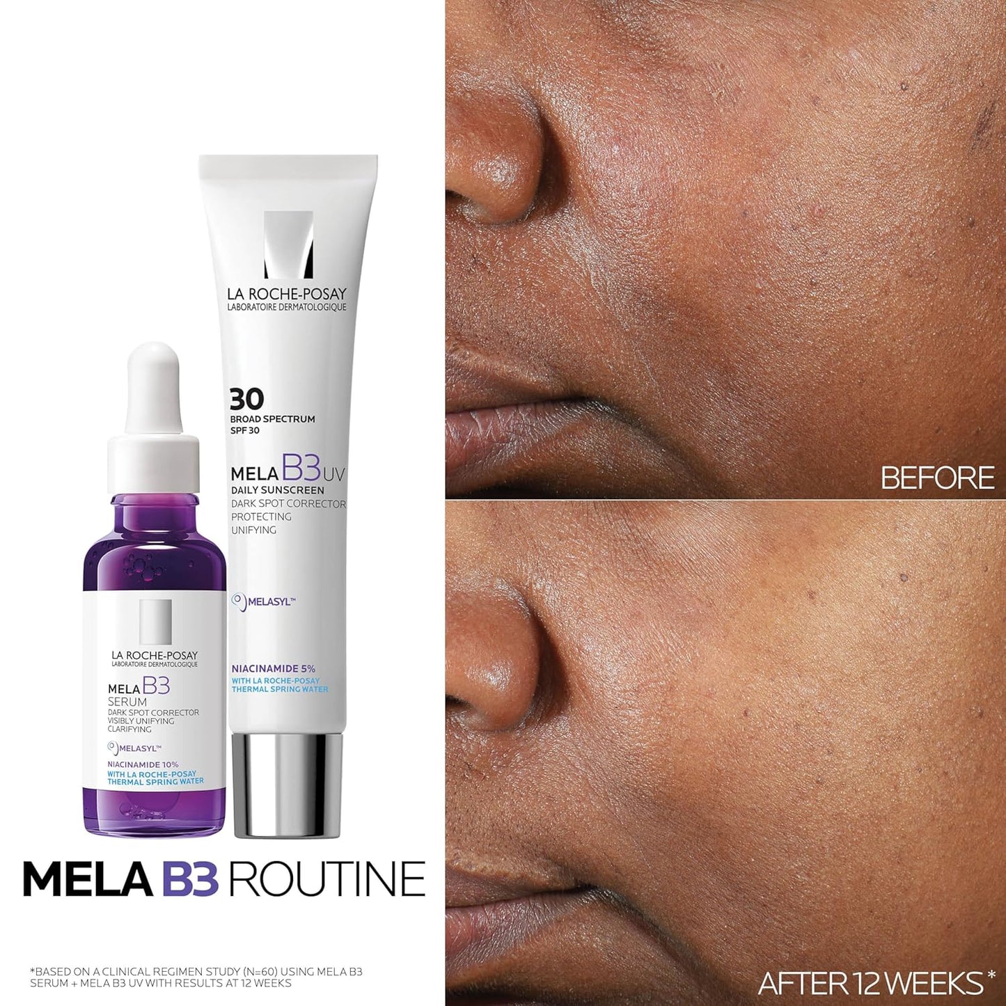 Mela B3 Dark Spot Corrector Serum with 10% Niacinamide (1 fl oz)